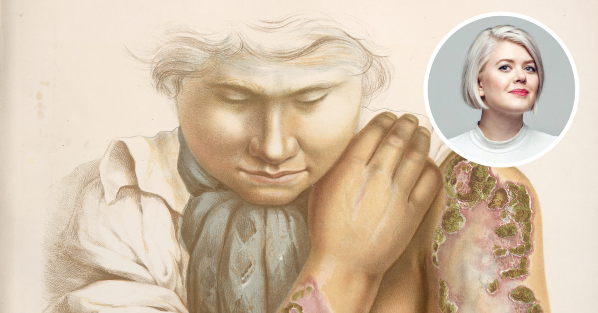 Ei natt med Venus, eit liv med Merkur. Ellen Støkken Dahl om syfilisens historie i Noreg