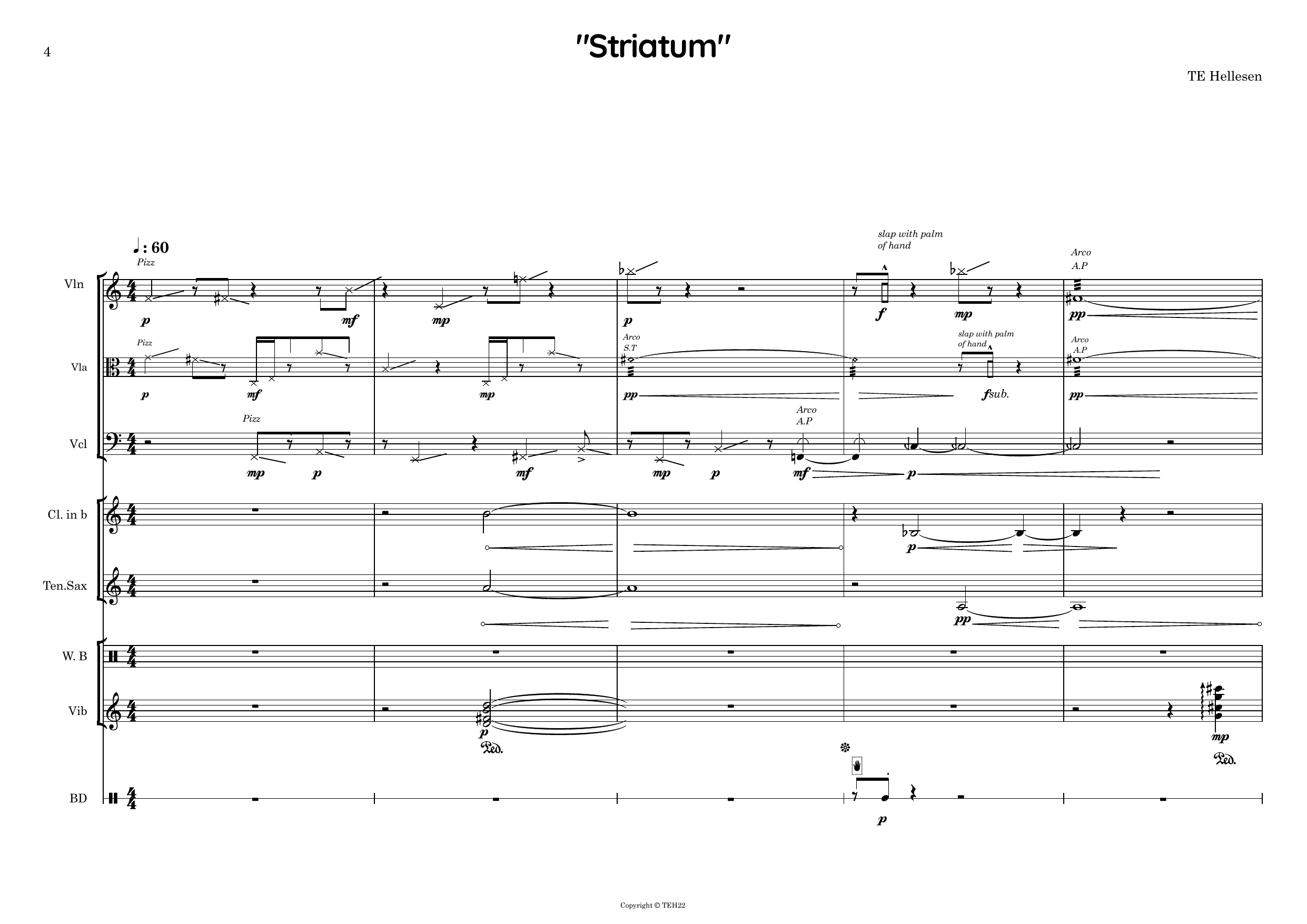 Striatum - Image 4
